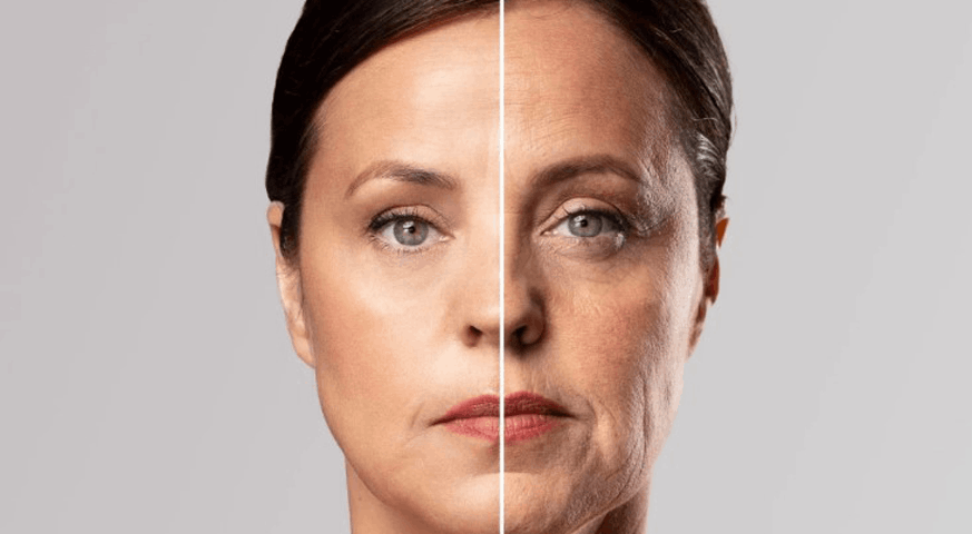 Ozempic Face: Why You Can Look Older After Weight Loss (And How to Fix It)